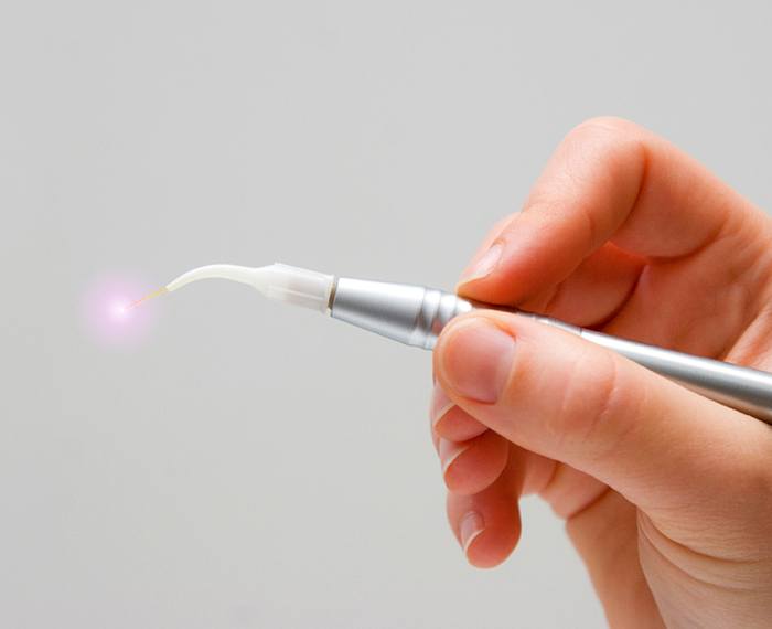 Hand held soft tissue laser