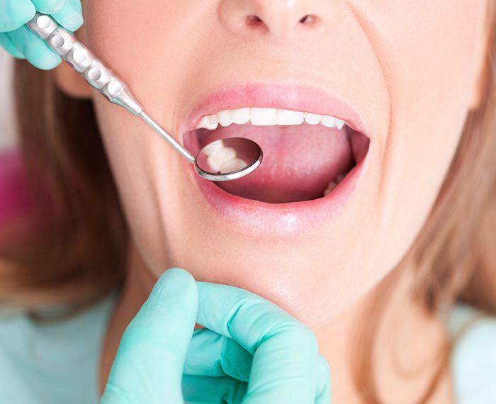 Dentist checking patient's metal free dental restoration