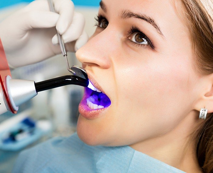 Patient receiving dental bonding treatment