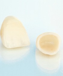 Close-up of dental crowns in Gilbert, AZ
