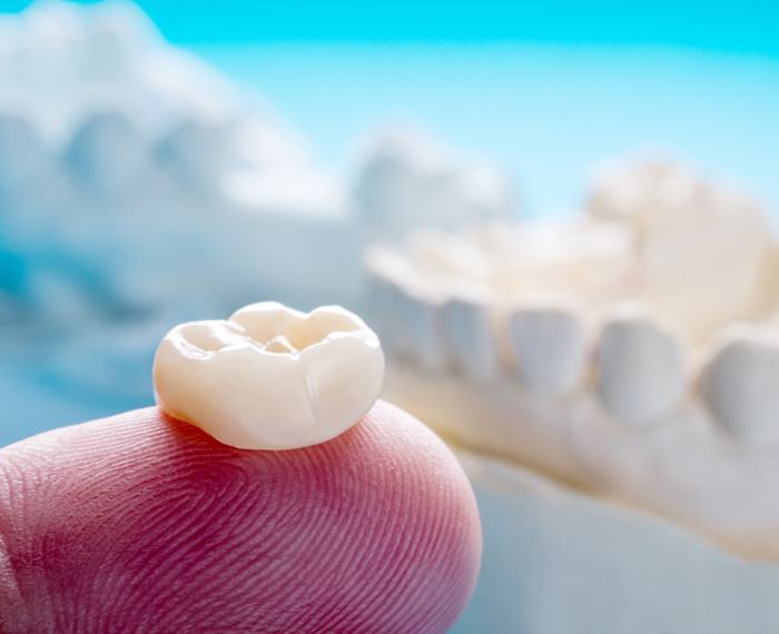 Man smiling with dental crown in Gilbert