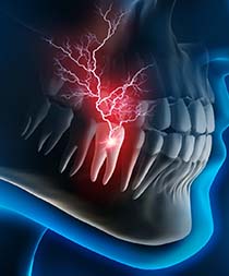 X-ray diagram of a toothache in Gilbert