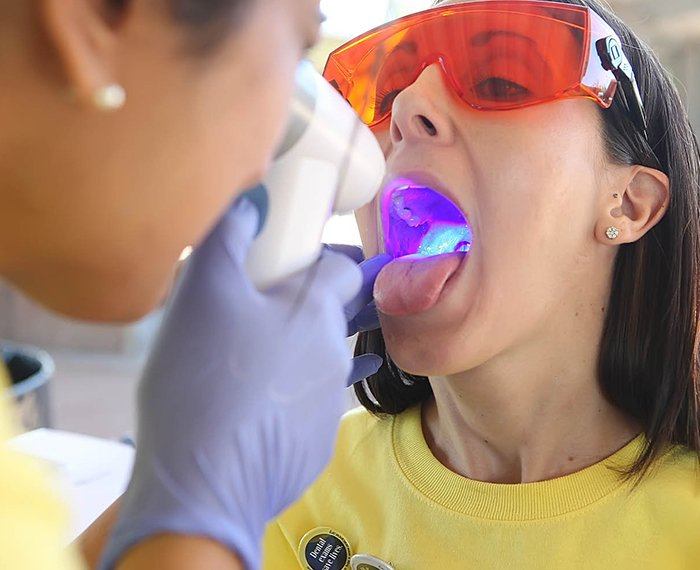 Dentist performing an oral cancer screening