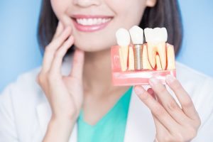 a dentist showing a patient dental implants